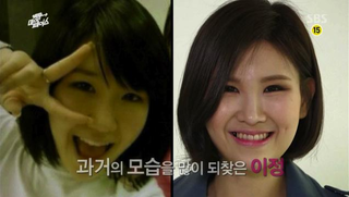 Illustration for article titled Depressing? Inspirational? Reverse Plastic Surgery Show Hits Korea